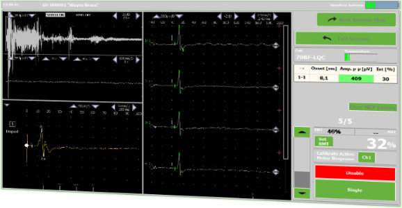 Software DuoMAG rTMS