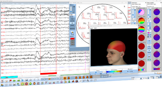 TruScan EEG Explorer